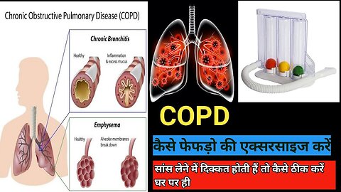 Chronic Obstructive Pulmonary Disease (COPD)|Symptoms सांस लेने में दिक्कत होती हैं तो कैसे ठीक करें