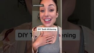 Home whitening ideas for teeth whitening at home 001