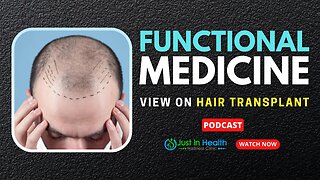 Functional Medicine View on Hair Transplant