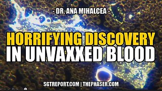 Dr. Ana Mihalcea - Horrifying Discovery in Unvaxxed Blood