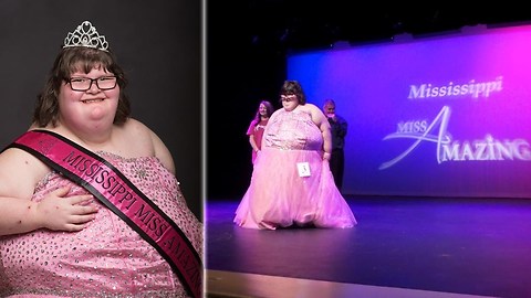 380-Pound Teen With 'Chronic Eating' Condition Wins Pageant Crown