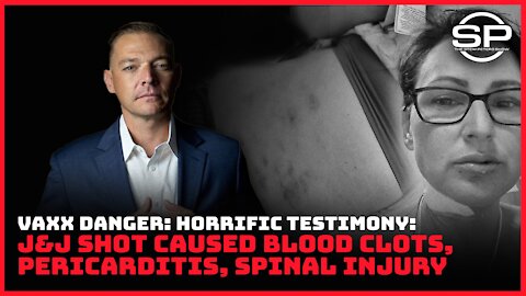 Jab Mandate Victim Speaks Out: HORRIFIC Injuries EVERYONE Should See