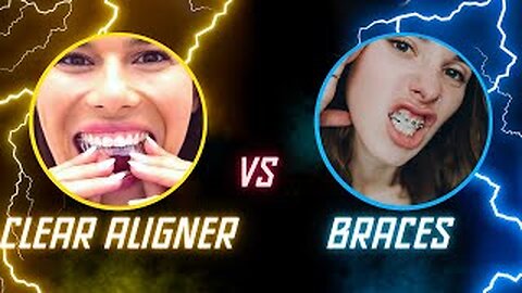 Clear Aligners(Invisalign) vs Braces || Which Is Better For You