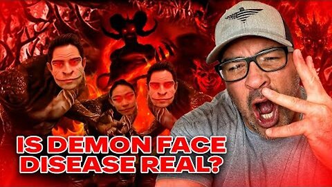 REAL?! DEMON FACE SYNDROME REVEALED..SHAPESHIFTERS AMONG US? YOU WILL NOT BELIEVE THIS.