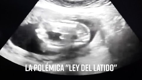 La 'Ley del Latido' causa polémica en EEUU