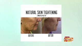 Tighten Sagging Skin