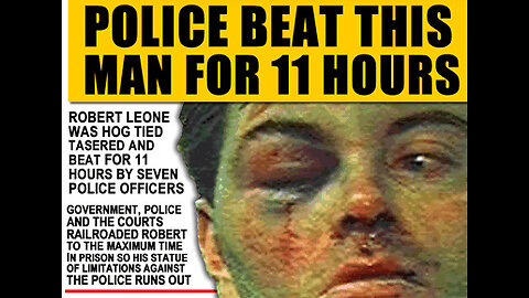 Police Brutality Worse than Rodney King - The Robert Leone Story