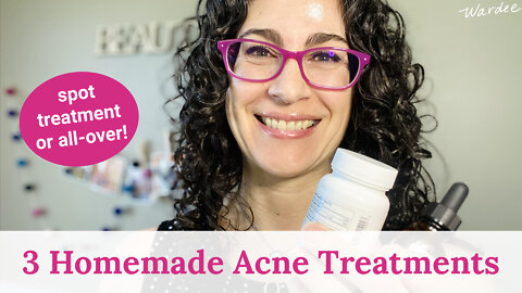 3 Homemade Acne Treatments: Spot Treatment or All-Over!