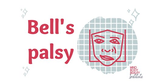 Bell's Palsy