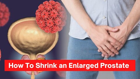 enlarged prostate treatment