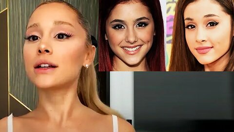 Ariana Grande gets emotional about botox and fan bullying