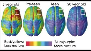 Adults vs Kids Neurological Differences in Language Learning (@Raising Multilinguals LIVE )