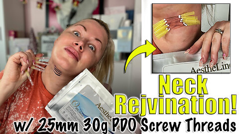 Neck Rejuvination with 25mm 30g PDO Screw Threads from Acecosm.com | Code Jessica10 Saves you Money!