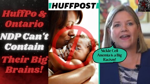 Galaxy Brain Racism Claims: HuffPo's Hatred of Numbers & Ontario NDP's Issue With Sickle Cell Anemia