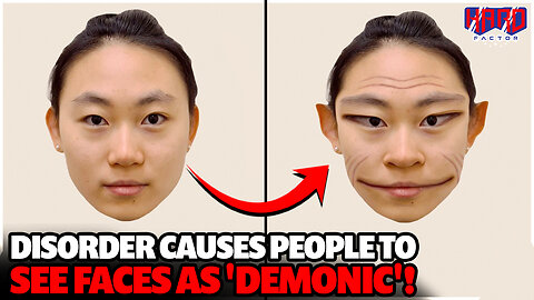 Rare disorder causes people to see faces as 'demonic' - Ep. 1426
