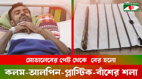 মোতালেবের পেট থেকে বের হলো কলম-আলপিন-প্লাস্টিক-বাঁশের শলা | Shaheed M. Monsur Ali Medical