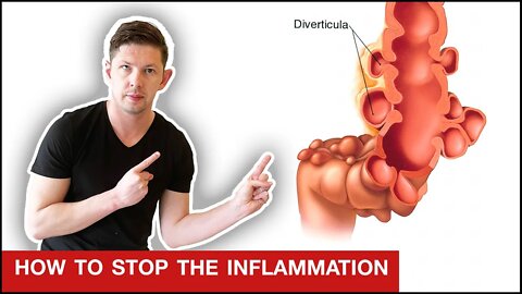 How to Heal Diverticulitis