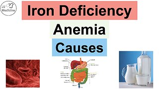 Causes of Iron-Deficiency Anemia | Dietary, Losses & Utilization