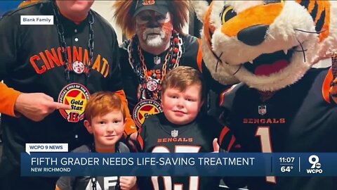 Young Bengals fan in need of life-saving procedure