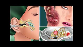 treatment infected wounds and get rid of insects in the ear | Relax With Mzogzage