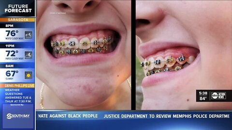 Tampa orthodontist disappears, leaving patients confused and angry