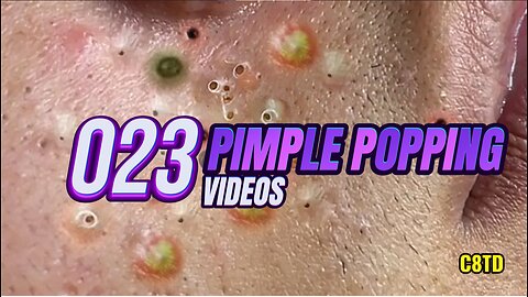 Satisfying Pimple Popping Videos 023