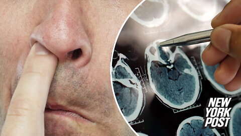 How picking your nose could increase risk of Alzheimer's and dementia
