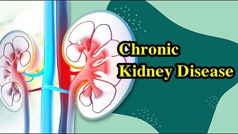 Chronic Kidney Disease: A Guide For Patients