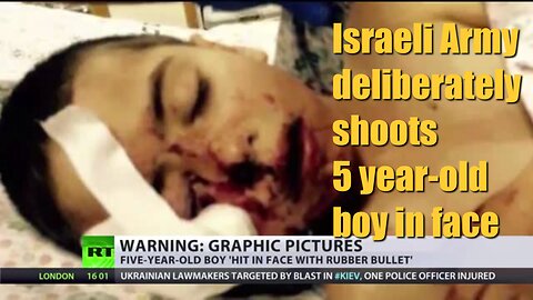 Israeli Army deliberately shoots 5 year old boy in face