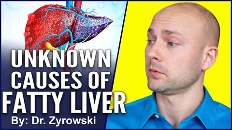 What Causes a Fatty Liver | 4 Ways to Fix | Dr. Nick Z