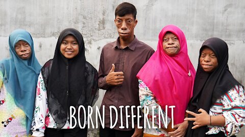 The Family Whose Faces Change Shape | BORN DIFFERENT