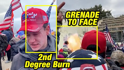 💥 Peaceful Patriot takes Grenade Blast from Police on January 6th