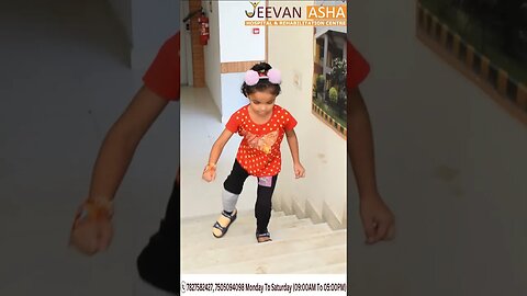 06 year's old Ritika lost a leg Jeevan Asha Hospital provided him #free of cost #modular #prosthesis