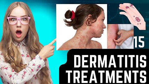 15 Dermatitis treatments