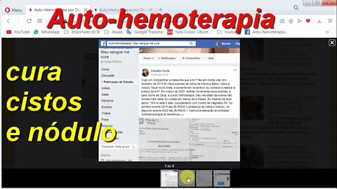 Auto-hemoterapia cura cistos e nódulo em menos de 4 meses.