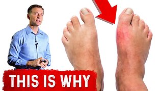 Why Do You Get Gout in Your Big Toe?