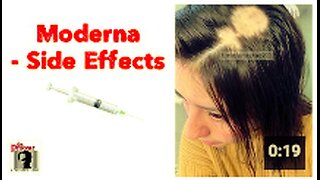 Moderna side effects 💉