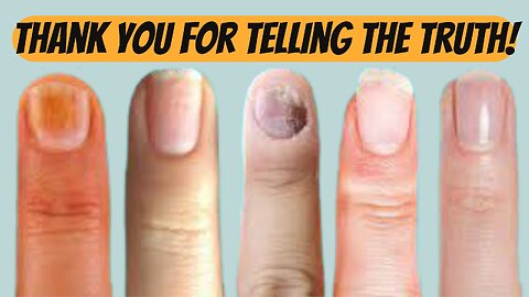 Discover Health Secrets in Your Nails