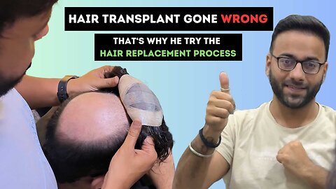 Hair Replacement Video #Baldness Solution I contact details : 7838163786