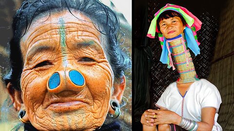 People With Rare and Unique Beauty Around the World