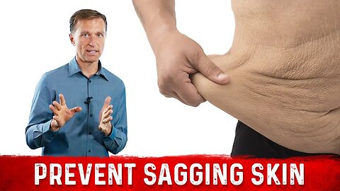 How To Prevent Sagging Skin with Losing Weight? – Dr.Berg On Loose Skin After Weight Loss