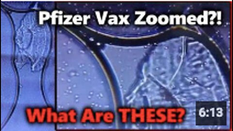 DISTURBING! Pfizer Vaccine Zoomed w/ Microscope?! Are Living Cells/ Organisms Mixed In?!