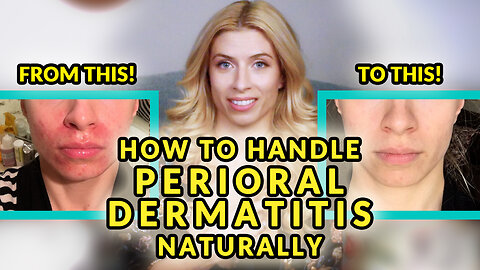 How to Handle Perioral Dermatitis Naturally