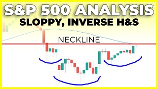 SP500 & JUST ABOUT EVERYTHING ELSE MOVES HIGHER (Watch These Levels) | S&P 500 Technical Analysis
