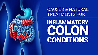 Causes & Treatments for Inflammatory Colon Conditions