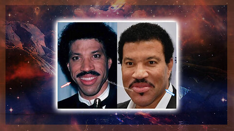 LIONEL RITCHIE'S CHIN