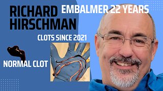 EMBALMERS FIND STRANGE CLOTS SINCE 2021 RICHARD HIRSCHMAN