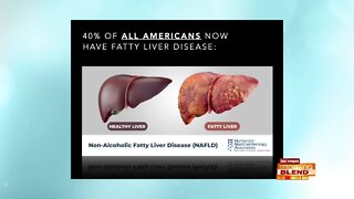 What is a Fatty Liver?