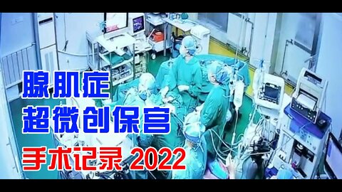 子宫腺肌症超微创保宫手术记录 20220906