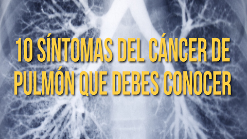 10 Síntomas Del Cáncer De Pulmón Que Debes Conocer